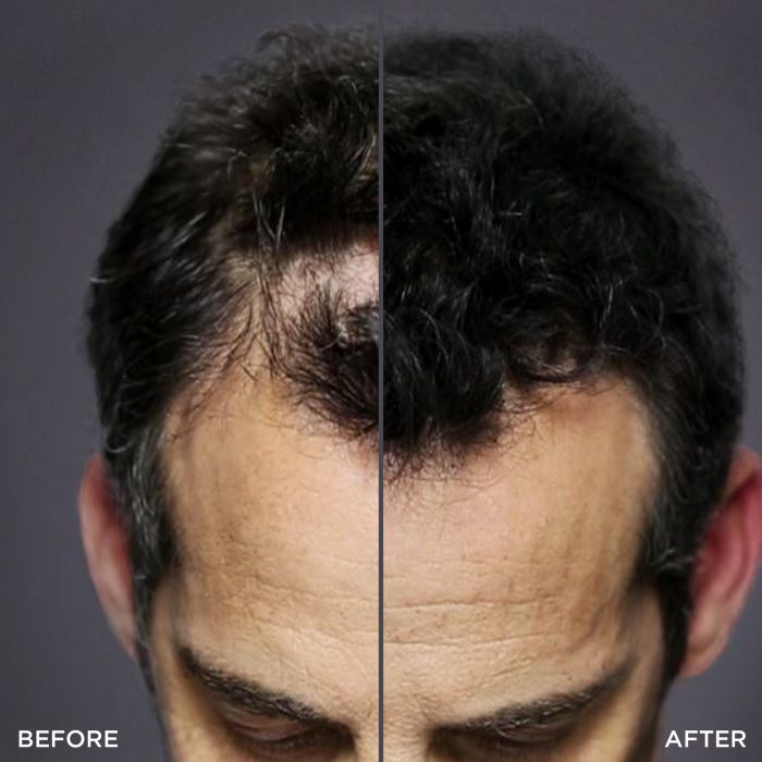 Toppik Hairline Optimizer - Perfectly Defined Hairline for a Natural Look